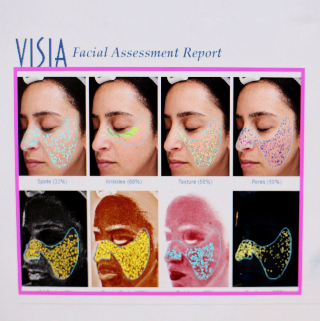 Blogger Sarah Lindner of The House of Sequins using VISIA Complexion Analysis at Truth and Beauty spa in Roslyn